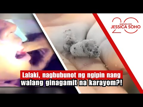 Lalaki, nagbubunot ng ngipin nang walang ginagamit na karayom?! | Kapuso Mo, Jessica Soho