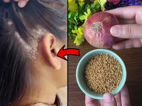 Your hair will grow 5 times faster, Homemade hair growth recipe