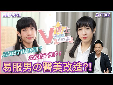 易服男の醫美改造?! 到底做了什麼項目？女性化了很多！【素人大改造】