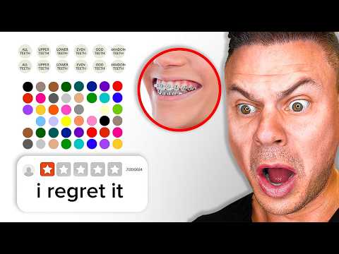 Dentist Reveals The BEST and Worst Elastic Colors For Your Teeth!