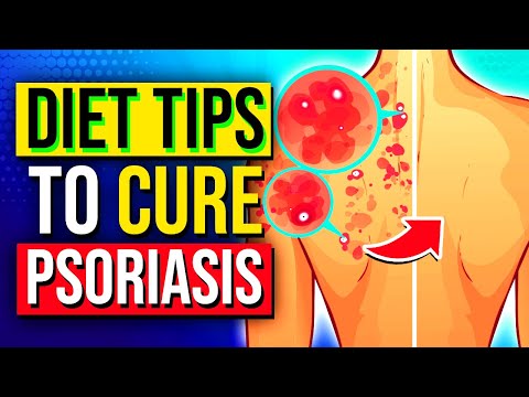 Diet Food Tips For Treating and Reducing Psoriasis