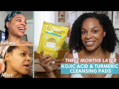 BEFORE AND AFTER using Kojic Acid & Turmeric Pads for THREE MONTHS