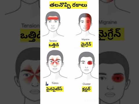 తల నొప్పి రకాలు |Types of Headache in Telugu #shorts #ytshorts #saanvidental #trendingshorts