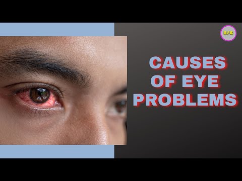 CAUSES OF EYE PROBLEMS #sight #eyedoctor #healthcare #optical #eyetreatment #lowvision #eyeproblem