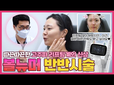 [밴스의원 강서화곡점] 고주파 리프팅계의 HOT한 신상 볼뉴머 반반시술🔥리프팅 유목민 모델도 찐으로 감탄한 볼뉴머😯💖