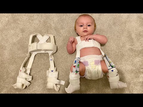 Day 18 With Our Pavlik Harness (DDH) - New Harness, No Scan