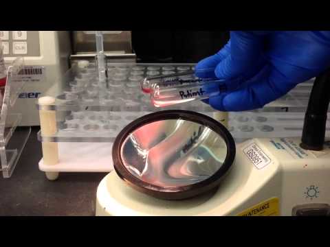 Blood Bank- Antibody Screen (Tube Method)