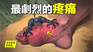 痛風：和生孩子的疼痛機制相同？為什麼這是最劇烈的疼痛？美國因為痛風而誕生？中國因為痛風而禁海？甚至還有古人攀比痛風？一步步破解，醫生們還發現了痛風背後更多的秘密……|自說自話的總裁