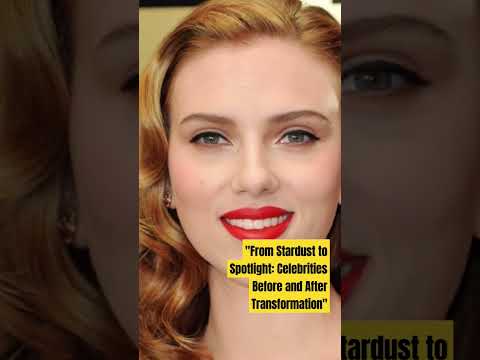 From Stardust to Spotlight: Celebrities Before and After Transformation #StarGlowUp #viral #youtube