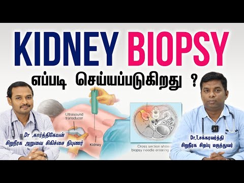 சிறுநீரக பயாப்ஸி ஏன் செய்ய வேண்டும்?எப்படி செய்யப்படுகிறது? How is  kidney biopsy procedure done?