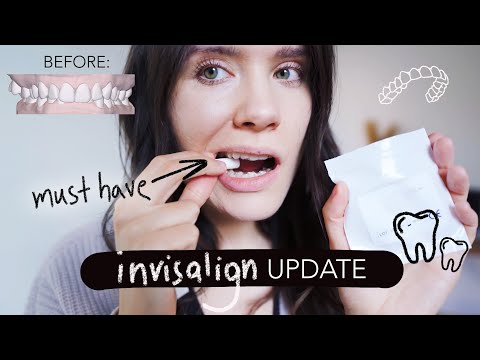 FIRST WEEK of INVISALIGN experience - Does it hurt? Cleaning trays + Necessities!