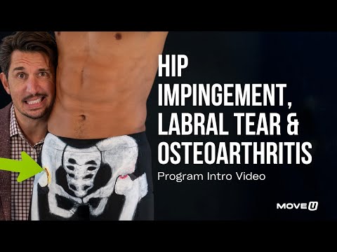 Hip Impingement, Labral Tear & Osteoarthritis Program Intro Video