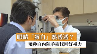 【胡裕昇醫師】眼睛「蛋白」熟透透？　飛秒白內障手術找回好視力｜健康醫療網