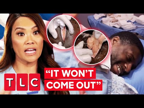 Dr. Lee Pulls Out Large Lipoma Located On Man's SPINE! | Dr. Pimple Popper: This Is Zit!