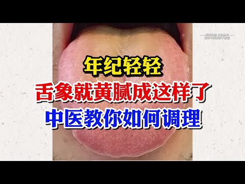 年纪轻轻，舌象就黄腻成这样了，中医教你如何调理？