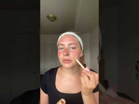 why you should ALWAYS apply sunscreen