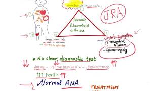 Juvenile Idiopathic Arthritis (JIA) - Juvenile Rheumatoid Arthritis (JRA) - mnemonic