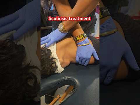 Chiropractic treatment for Scoliosis #worldfamouschiropractor #drrajneeshkant