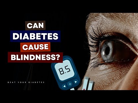 Can Diabetes Cause Blindness? Find Out If You Are At Risk!