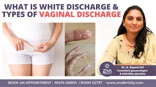 White Discharge || Types And Treatment For Vaginal Infections || Dr K Nayani Sri