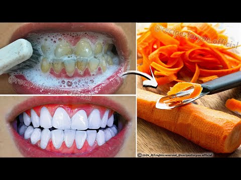 Secret that Dentists don't want you to know: Remove Tartar and Teeth Whitening in just 2 minutes🪥🥕