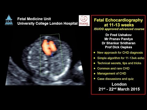 Fetal echocardiography at 11-13 weeks: ISUOG 2015 advanced course