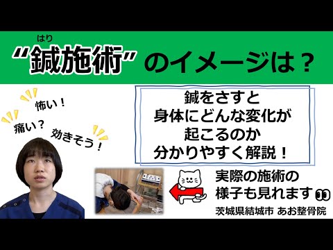 【当院の紹介】鍼(はり)施術について分かりやすく解説！｜茨城県結城市 あお整骨院