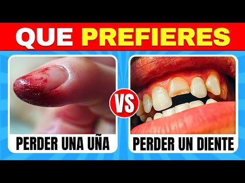 ¿Qué Prefieres? ¡Las 100 elecciones MÁS DIFÍCILES de todas! 🔥😱🧠 Edición EXTREMA