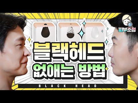 블랙헤드 없애는 방법(feat. 화이트헤드, 피지) 🔍 이거면 끝! [피부조정]