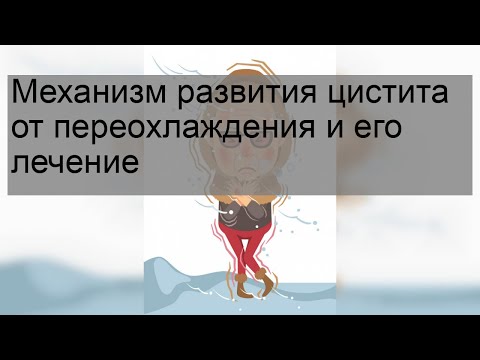 Механизм развития цистита от переохлаждения и его лечение