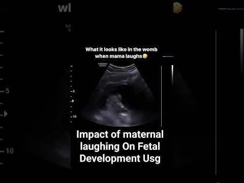 impact of maternal laughing on Fetal development #babyultrasound #pregnancyscan #pregnancy