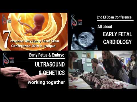 Early Fetal Scan Conference 2019: Future of the 11-14 weeks Scan.