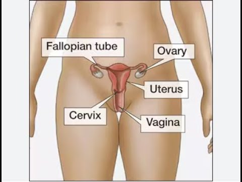 Pelvic inflammatory disease PID #pelvicinflammatorydisease  #health #ultrasoundtech #science