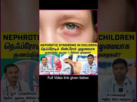 NEPHROTIC SYNDROME Treatment  in tamil-நெஃப்ரோடிக் சிண்ட்ரோம் குணப்படுத்தக்கூடியதா?சிகிச்சை முறைகள்?