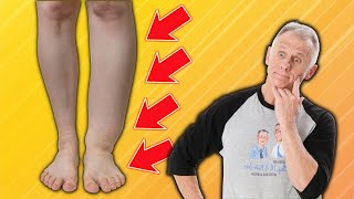 How To Fix Foot & Ankle Swelling; Everything You Need To Know!