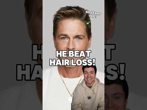 How Rob Lowe beat HAIR LOSS! 😲