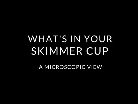 Reef Tank Microscopy  - Whats in your skimmer cup?