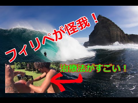 フィリペ・トレド チョープーで怪我 その時の治療法がすごい 2018 WSL