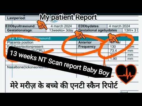 My patient 13 weeks NT Scan Report of Baby Boy explain by Dr Aneela manzoor Urdu | Hindi