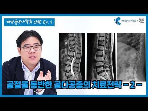 [대한골대사학회x청년의사 영상CME③] 골절위험 높은 골다공증 환자, 치료제 선택은 어떻게?