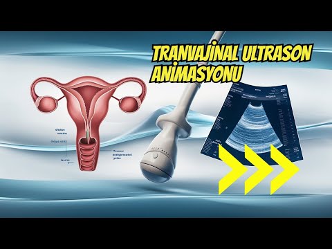 Why is gynecological ultrasound important? Which one should I prefer? Abdominal or transvaginal?