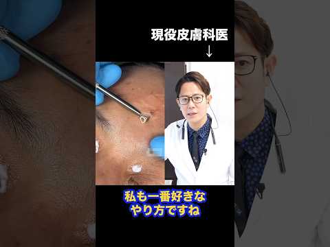 A Japanese dermatologist explains how to remove milia.