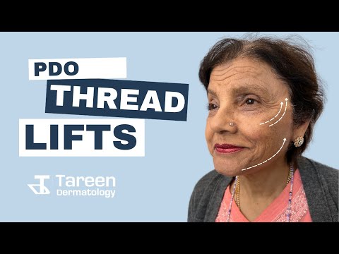 PDO Thread Lifts at Tareen Dermatology