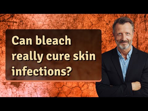 Can bleach really cure skin infections?