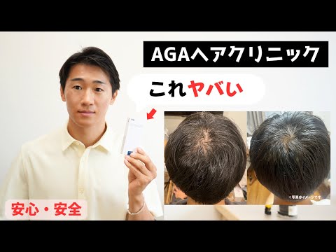 AGAヘアクリニックが魅力的すぎた・・・その理由とは？