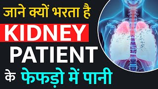 जाने क्यों भरता है kidney Patient के फेफड़ो में पानी | Pleural Effusion Causes | Symptoms