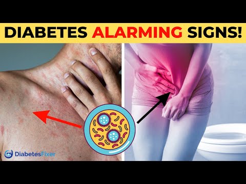 10 Signs Your Blood Sugar Is High