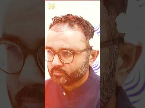 New Video Ft. Parthiv Patel | Parthiv Patel Hair Transplant | Medlinks #shorts #shortsfeed