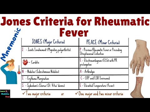 Jones Criteria for Rheumatic Fever | Jones Criteria for Rheumatic Fever Mnemonic | Jones Criteria