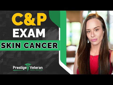 What to Expect in a C&P Exam for Skin Cancer | All You Need To Know